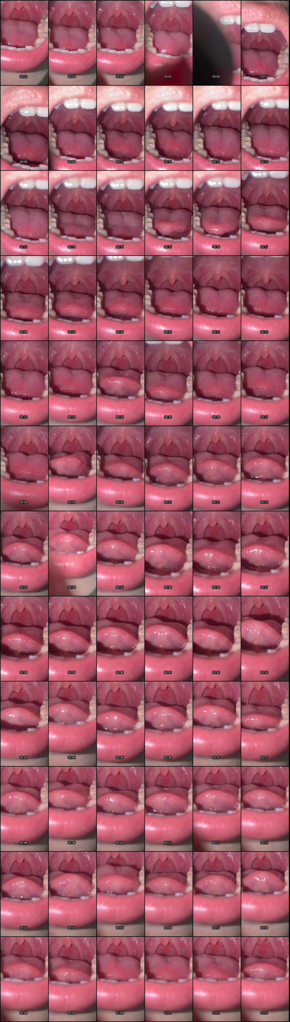 抖音女大学生香菇终结者：刺激口腔检查全过程