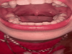 抖音女大学生口腔检查惊艳表演，香菇终结者第三弹！