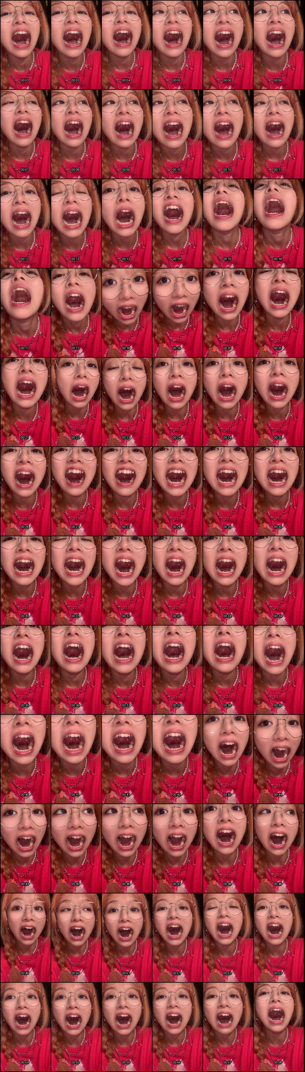 抖音女大学生惊艳口腔检查！香菇终结者强势登场