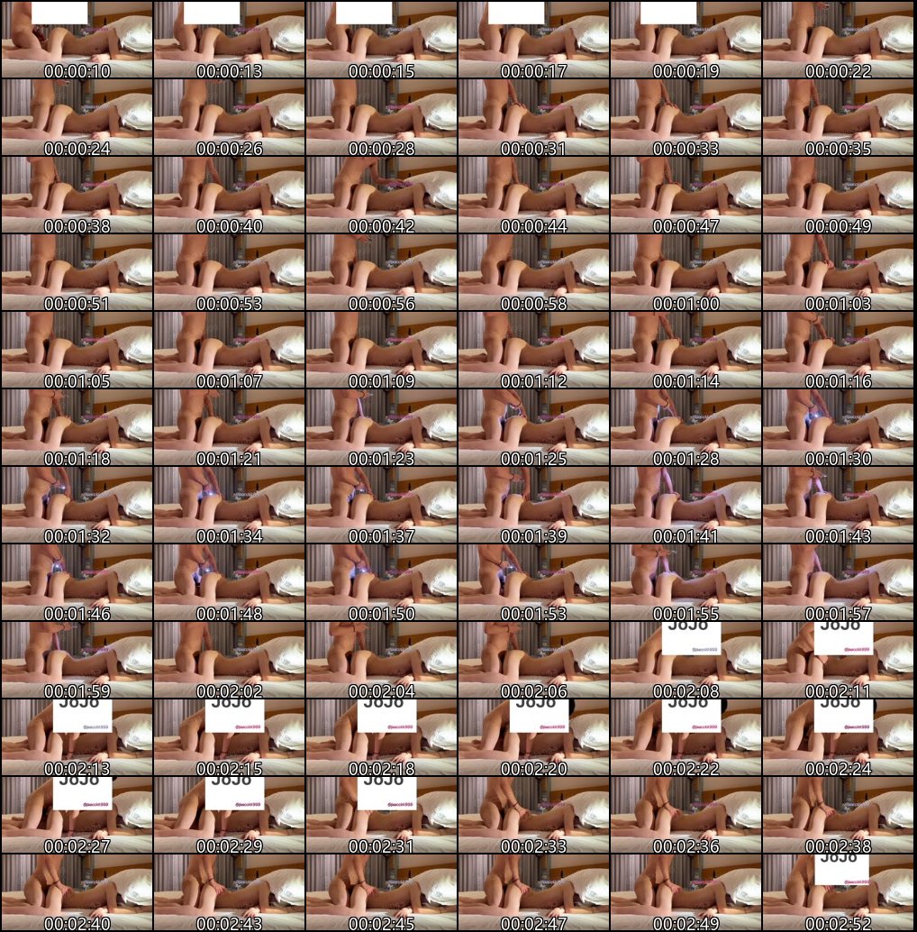 实习护士JoJo的精彩故事第二集